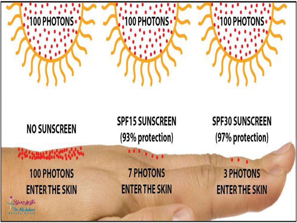 SPF در کرم های ضد آفتاب به چه معناست؟ spf مناسب ضدآفتاب چند است؟