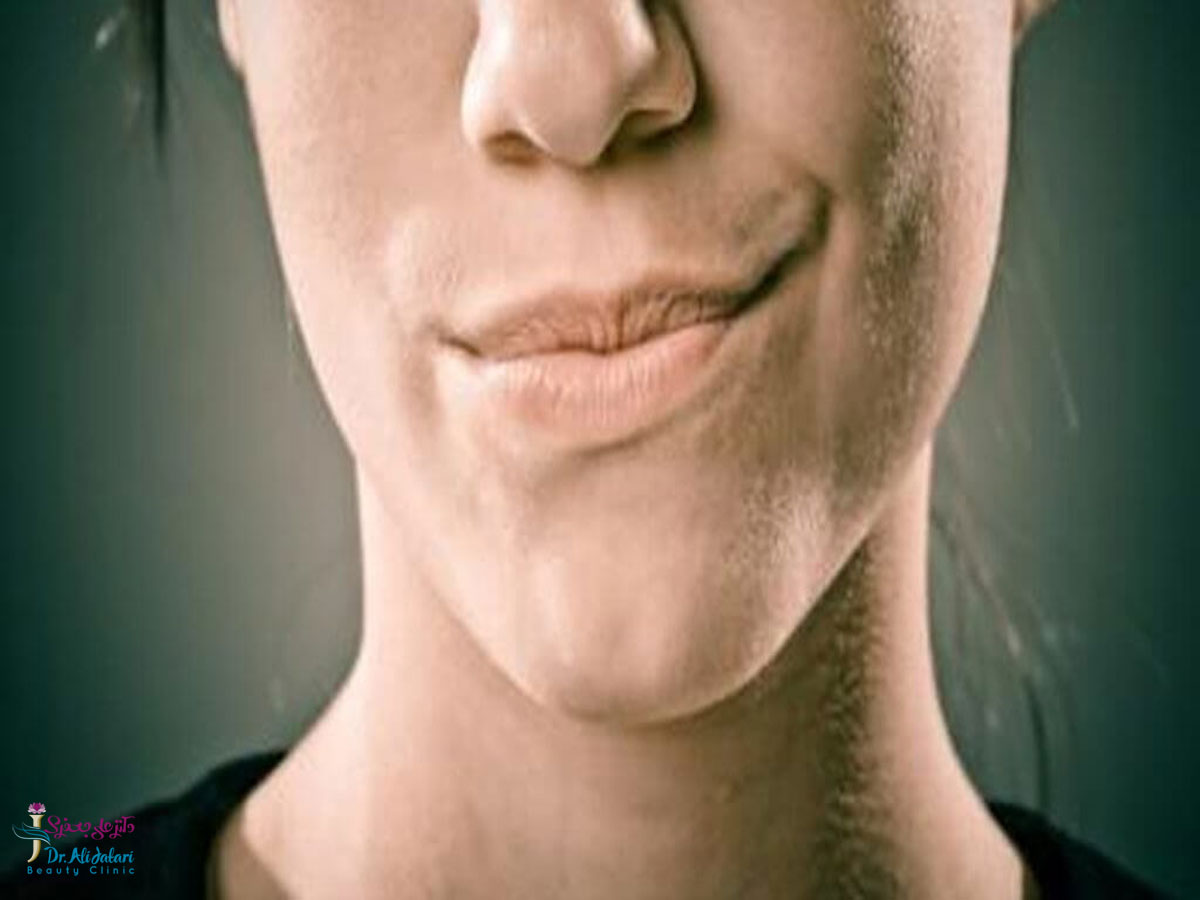 волосы на лице у женщин на груди фото 102
