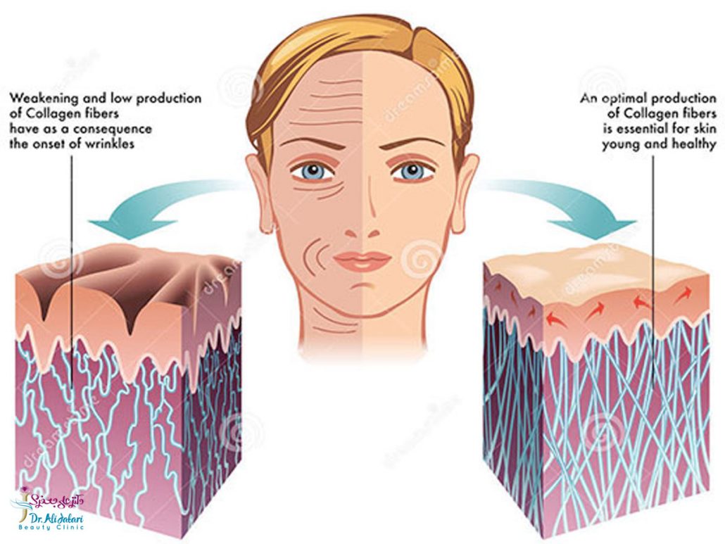 مکمل های کلاژن!!! کلاژن چه فوایدی برای بدن دارد؟