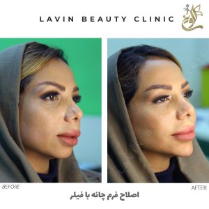 مادلینگ صورت